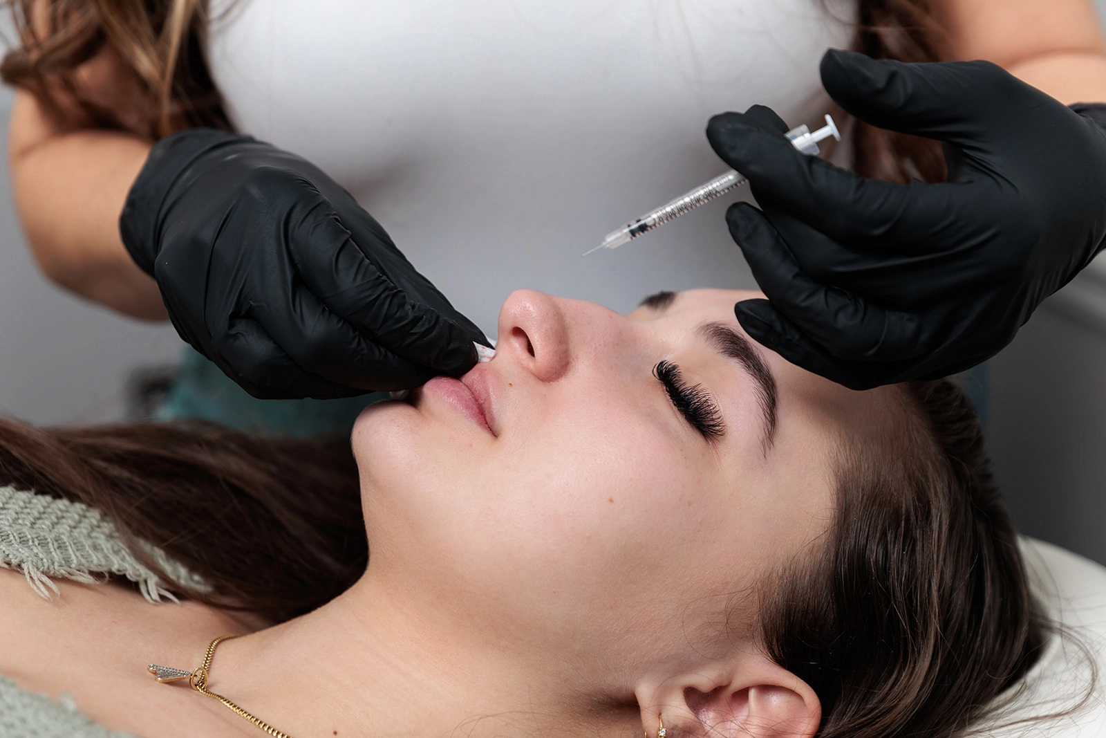 Fillers: Dos and Don’ts for a Natural Lift